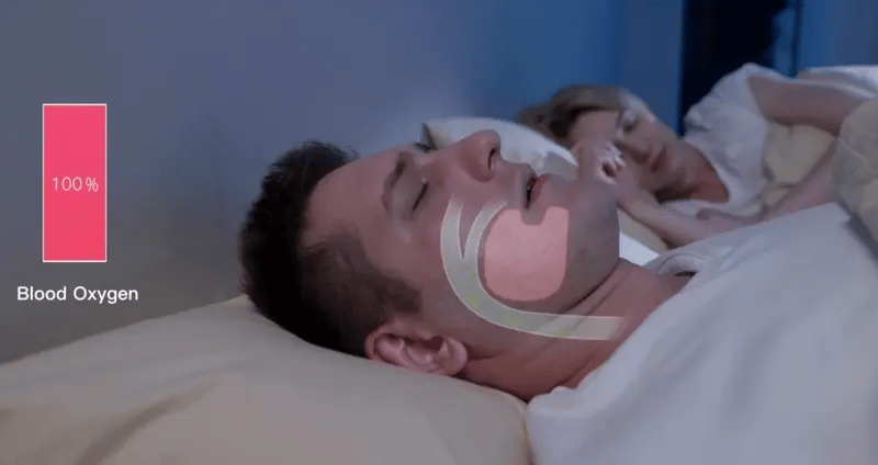 Sinais elétricos dos músculos da garganta — EMG