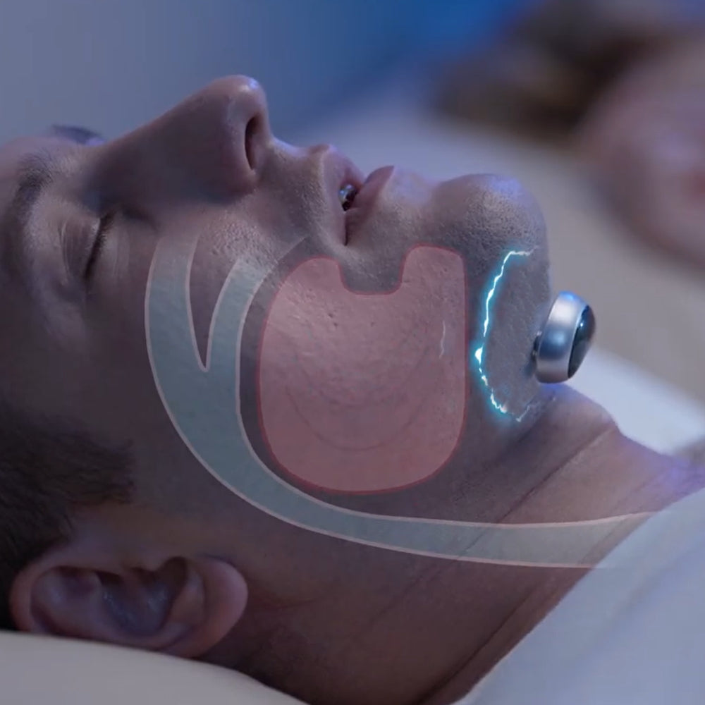 Passo 3 — EMS age durante o sono